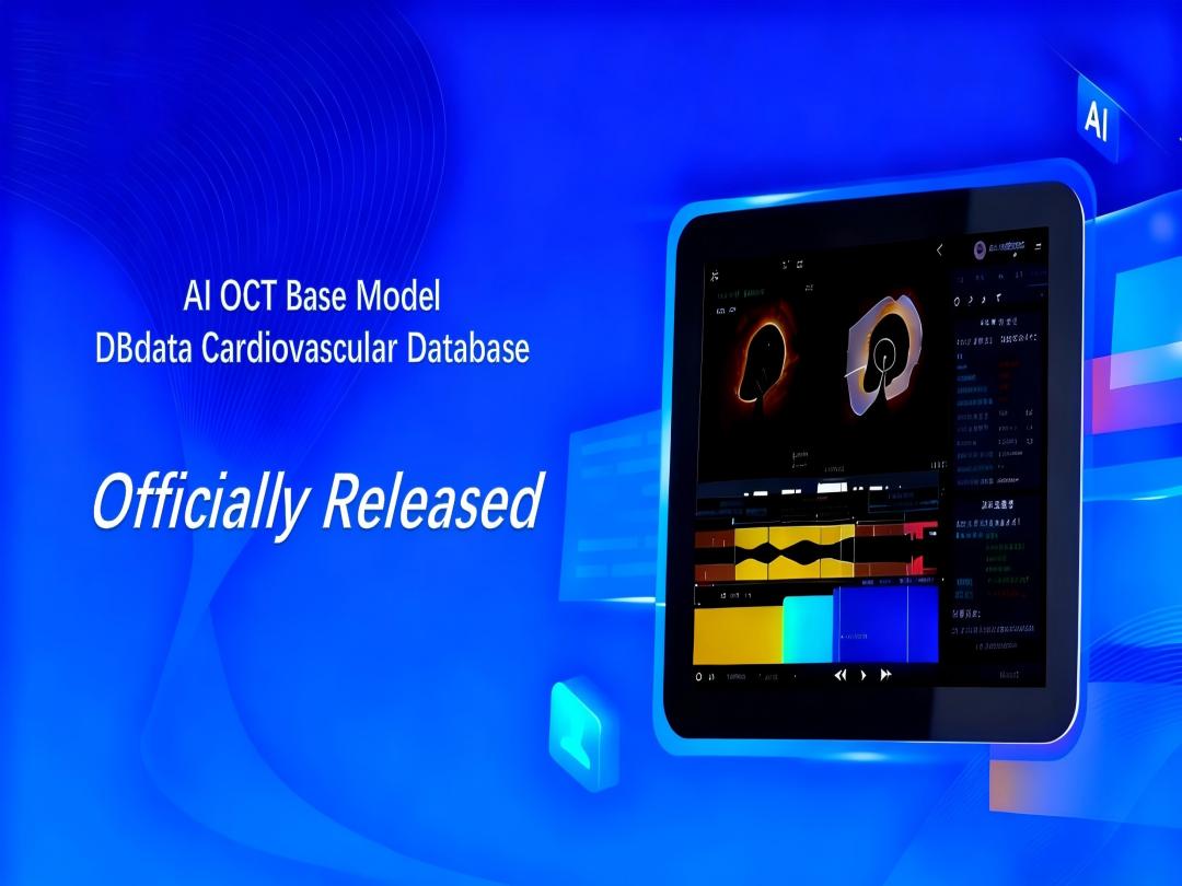 Non seguiamo, definiamo! L'imaging intravascolare cinese entra nell'era 