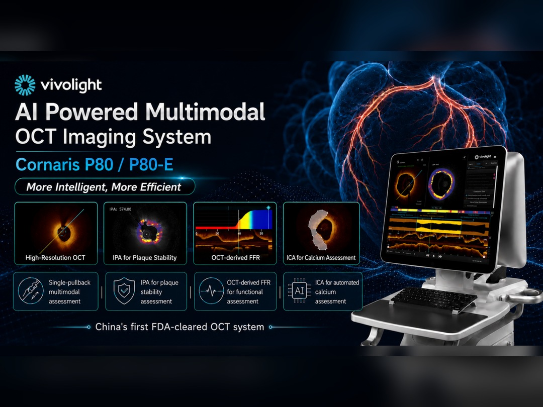 PCI guidata da IVUS/OCT: cosa ci dicono 8 ampi studi randomizzati